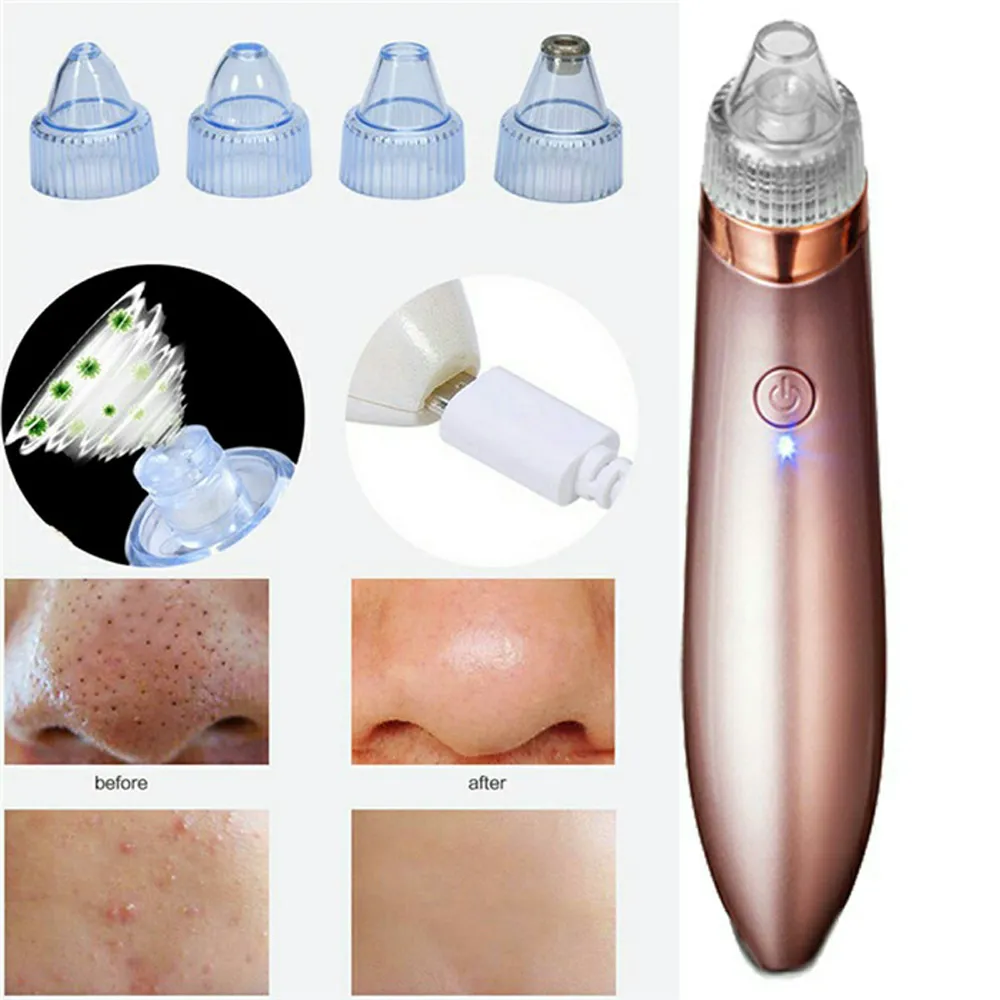 Electric Blackhead Remover Vacuum Pore Cleaner Electric blackhead remover vacuum pore cleaner for deep skin cleansing