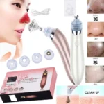 electric blackhead remover