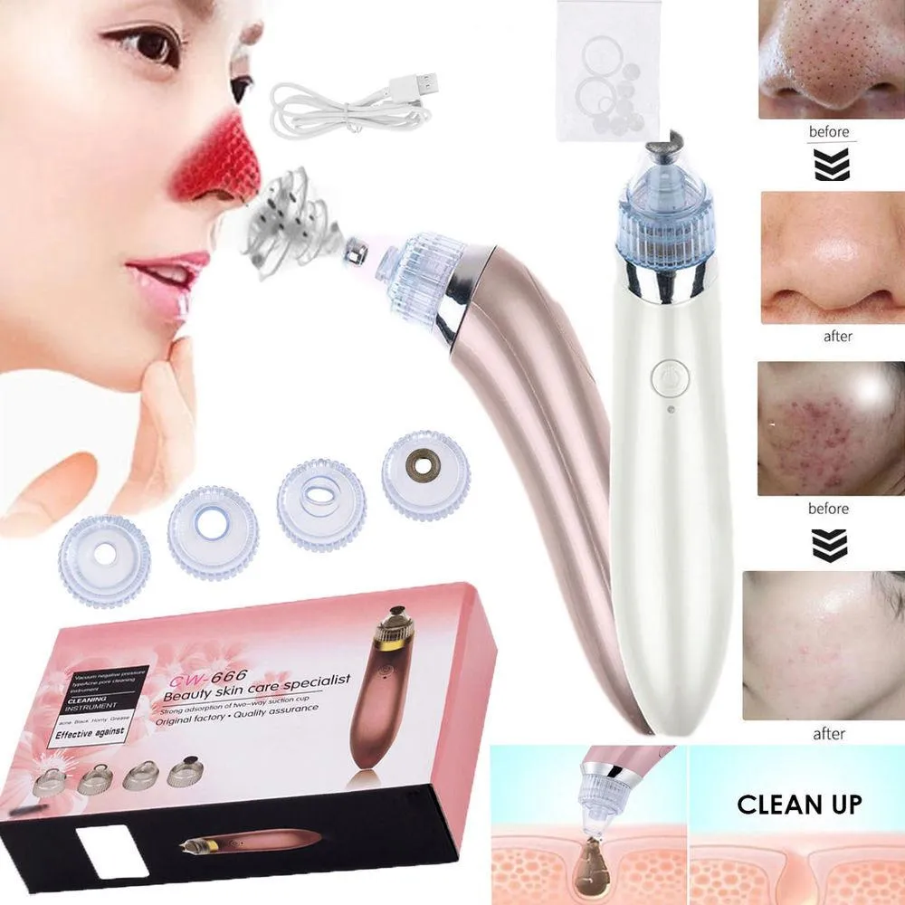 Electric Blackhead Remover Vacuum Pore Cleaner Electric blackhead remover vacuum pore cleaner for deep skin cleansing